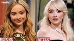 Did Sabrina Carpenter Undergo Cosmetic Procedures: Exploring the Evidence