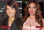 Farrah Abraham's Plastic Surgery: Candid Confessions