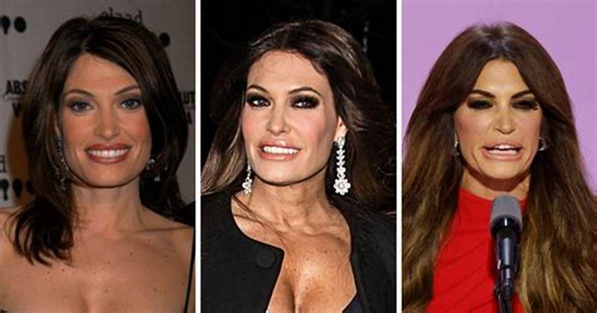 Kimberly Guilfoyle's Transformation: Before and After Surgery