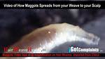 Maggots in Hair Extensions: a Shocking Health Hazard