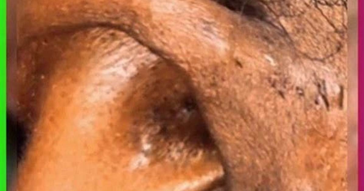 This Ear-Blackhead Removal Is So Satisfying It Has an Instant Replay